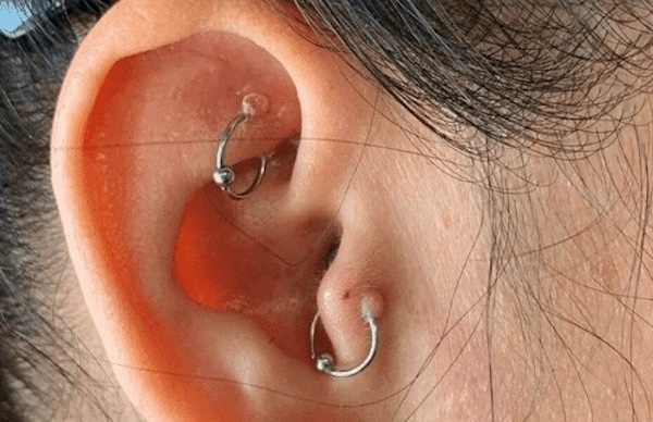 Xỏ tai đeo khuyên vòng được không?