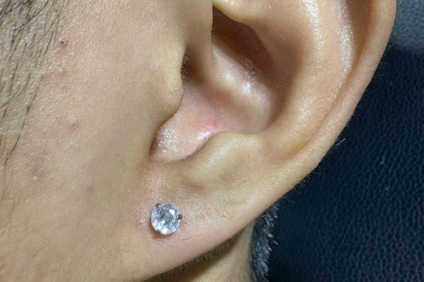 xỏ thịt tai cho nam giới