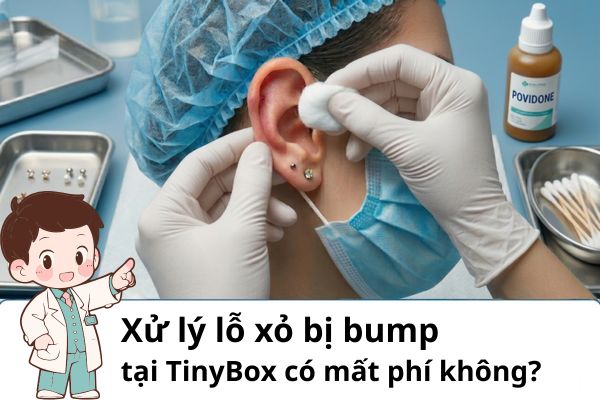 Xử lý lỗ xỏ bị bump tại TinyBox có mất phí không?