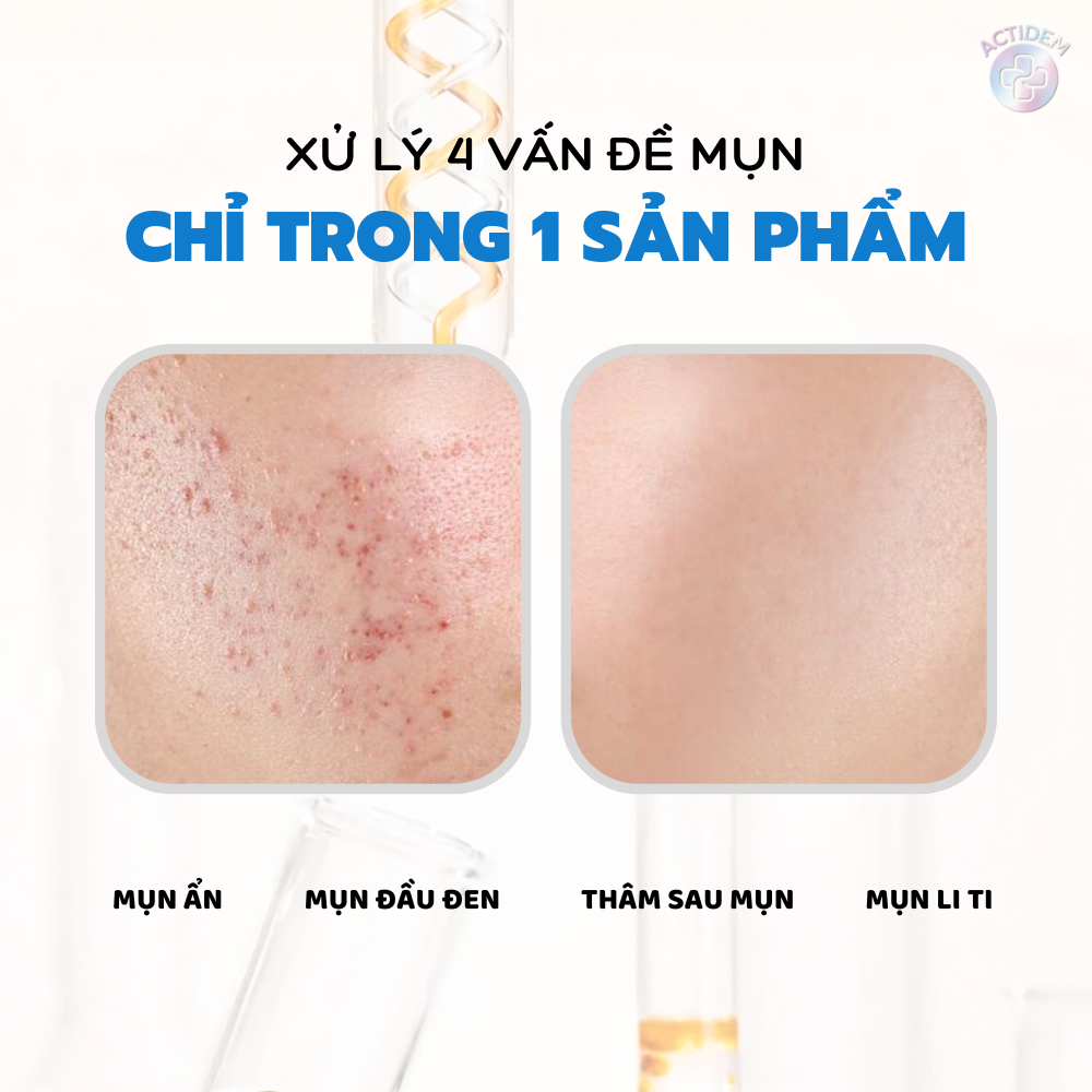 Công dụng Gel giảm mụn Actidem Derma Gel