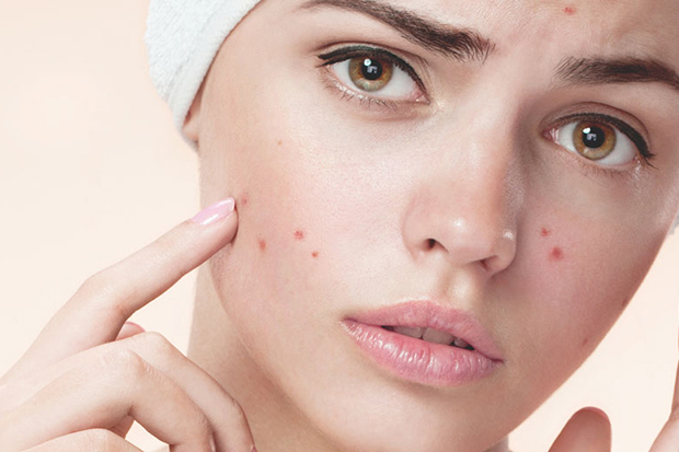 Dấu hiệu nhận biết da mụn