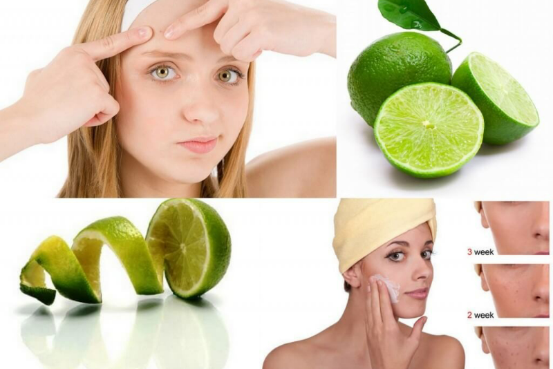 Dùng nước cốt chanh là cách làm mờ vết thâm mụn