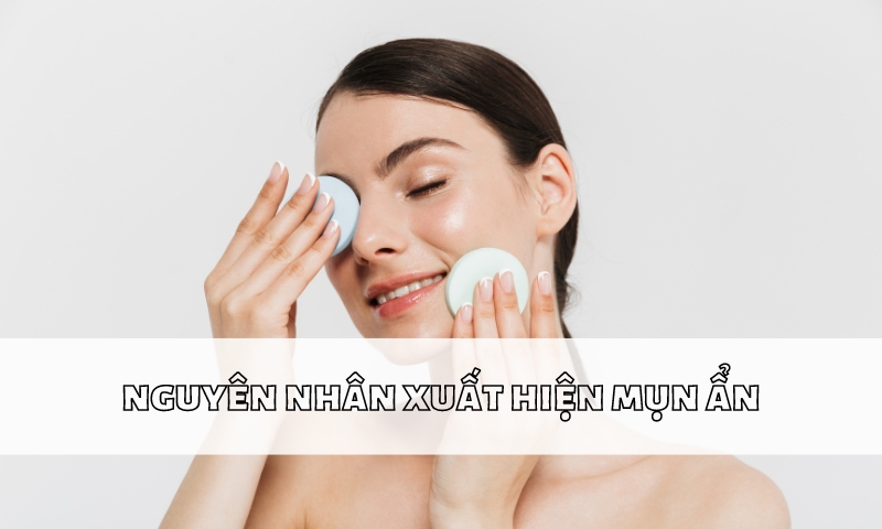 Nguyên nhân xuất hiện mụn ẩn