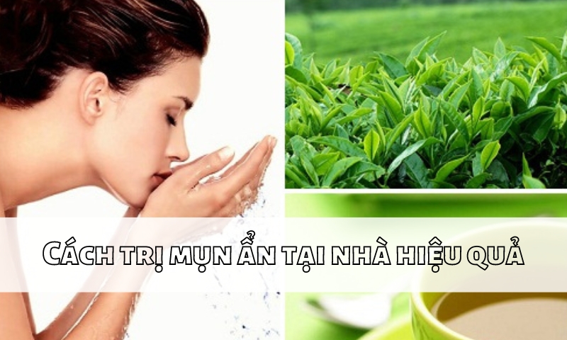 Cách trị mụn ẩn dưới da tại nhà