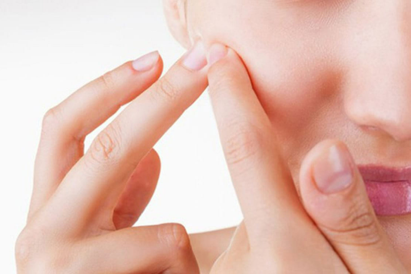 Cách trị mụn viêm ngay tại nhà