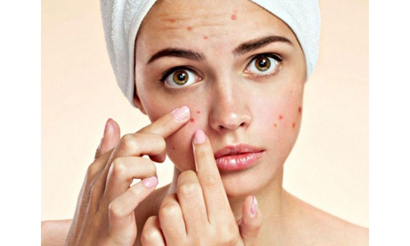 Cách chăm sóc da mụn và thâm