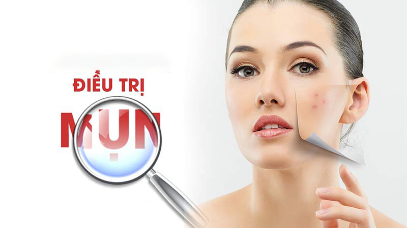 L-Cystine có công dụng kháng khuẩn, điều trị mụn hiệu quả