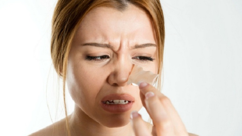 Mụn ẩn ở mũi gây nên khó chịu và mất thẩm mỹ