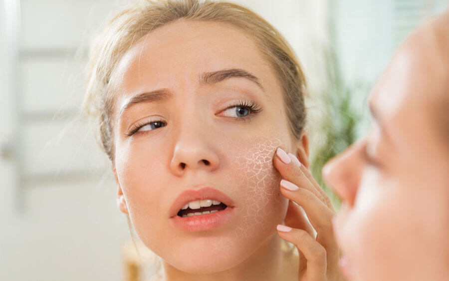 Không cung cấp đủ nước cho cơ thể có thể làm da khô và gây tắc nghẽn lỗ chân lông