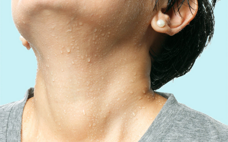 Mồ hôi là nguyên nhân trực tiếp gây nên mụn dưới cằm