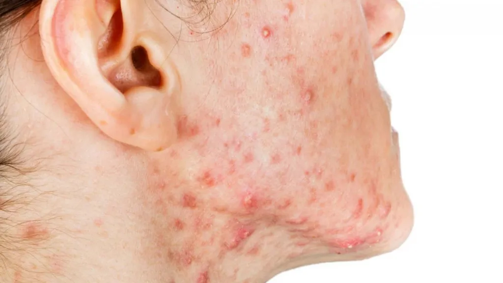 Ảnh hưởng của hormone