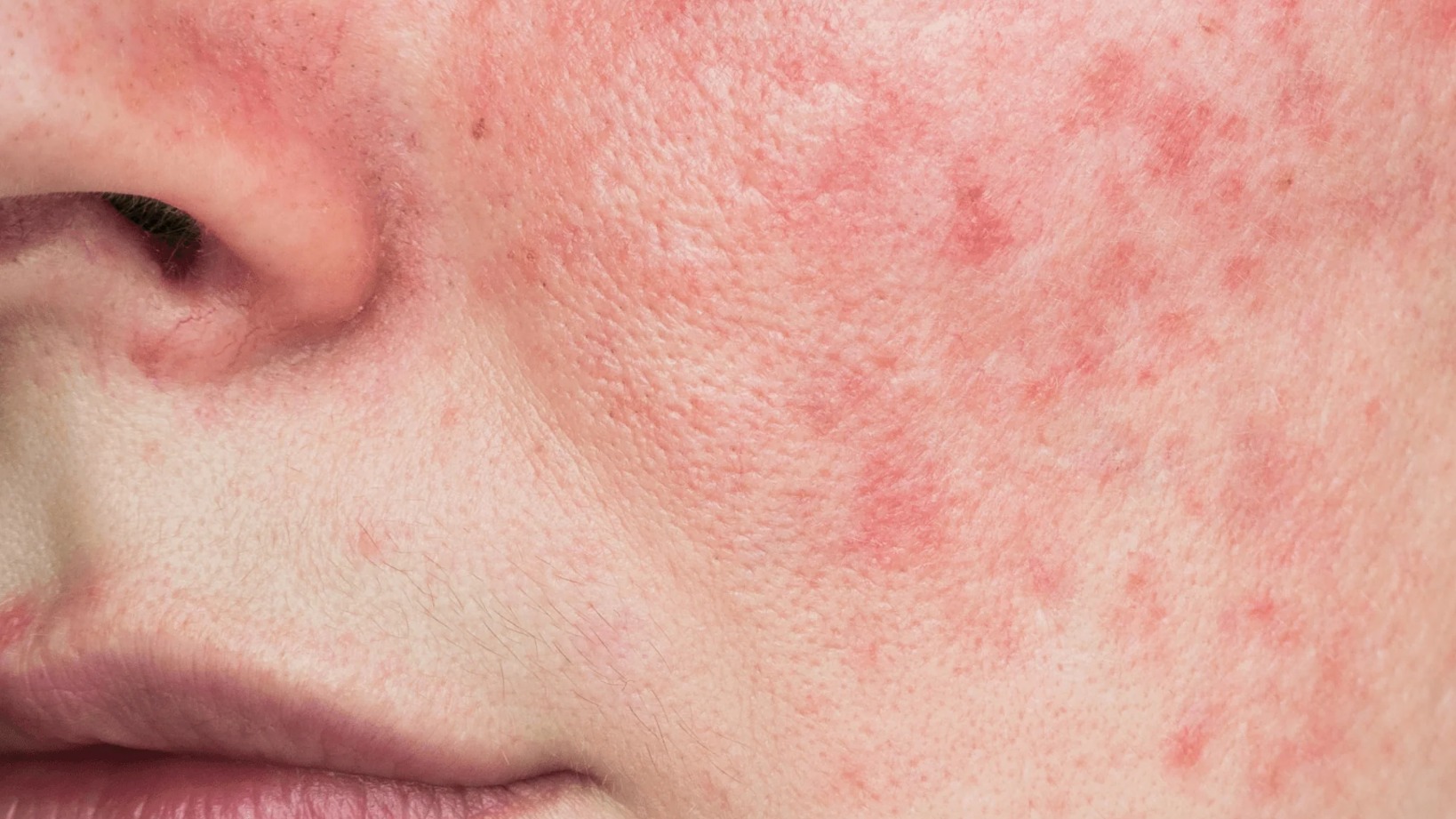 Sữa rửa mặt cần tránh kích ứng da