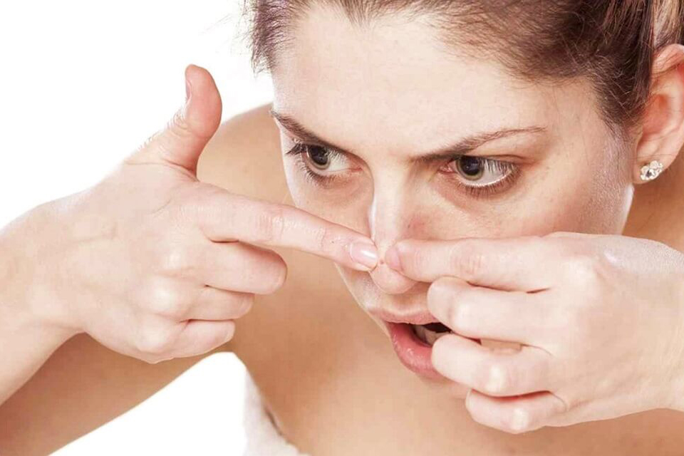 Bạn có nên nặn mụn ẩn không