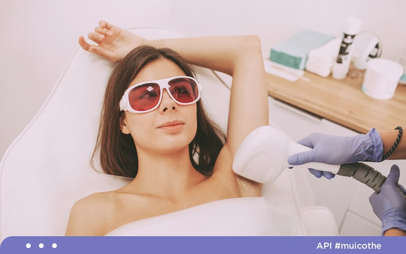 Triệt lông giúp vùng da nách luôn khô thoáng hạn chế mùi cơ thể