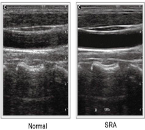 Máy Siêu Âm Xách Tay Eco3 Expert Chison: