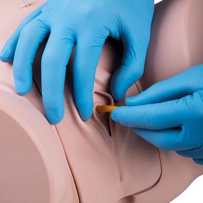 Quá trình thực hành đặt sonde tiểu cho nữ