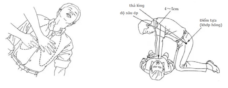 Động tác ép tim