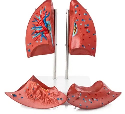 Mô hình phổi 4 Phần XC-HH-321