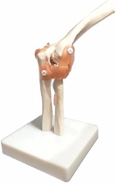 Mô hình xương khớp khuỷu tay