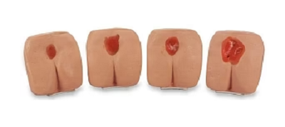 MÔ HÌNH THỰC HÀNH CHĂM SÓC VẾT LOÉT BỐN GIAI ĐOẠN - LF00934