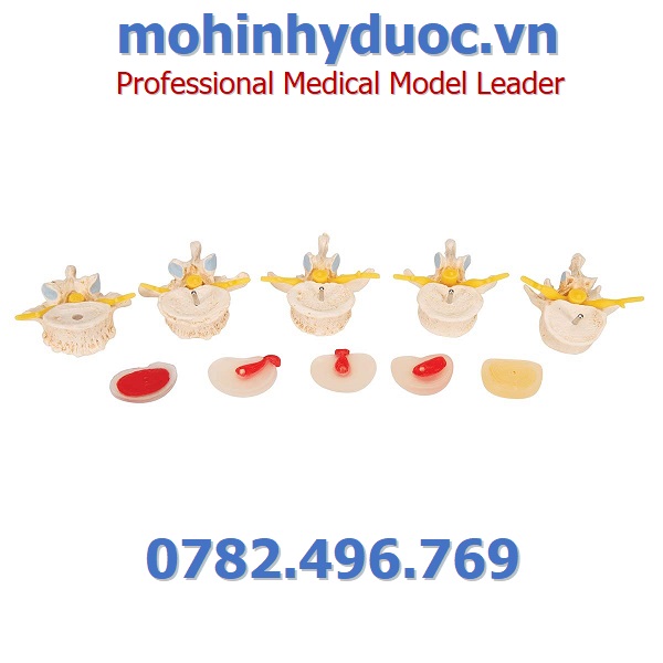 MÔ HÌNH CỘT SỐNG – 1000158 – 3B SCIENTIFIC