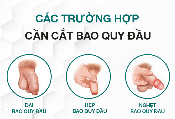 17 Tuổi Chưa Lột Bao Quy Đầu Có Sao Không?