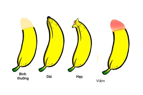 17 Tuổi Chưa Lột Bao Quy Đầu Có Sao Không?