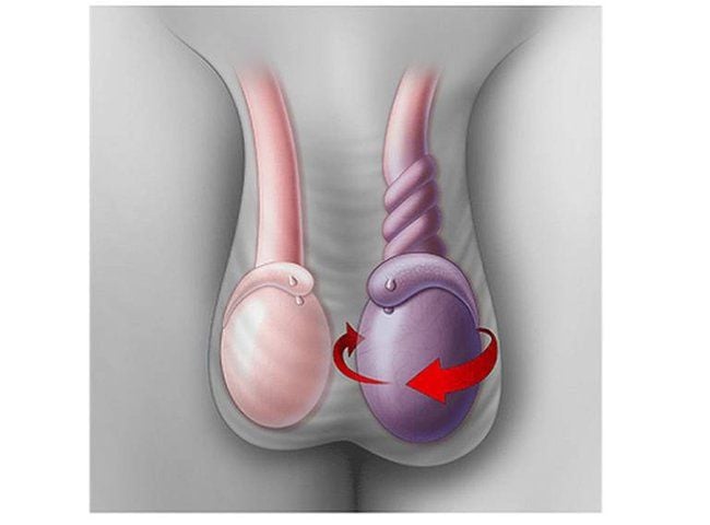 Bệnh Lậu Ở Nam Giới Là Gì? Dấu Hiệu Nhận Biết Sớm Và Cách Phòng Chống Hiệu Quả Nhất