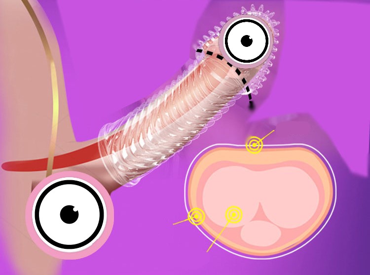 Bao cao su đôn dên vân gợn sóng đầu gai