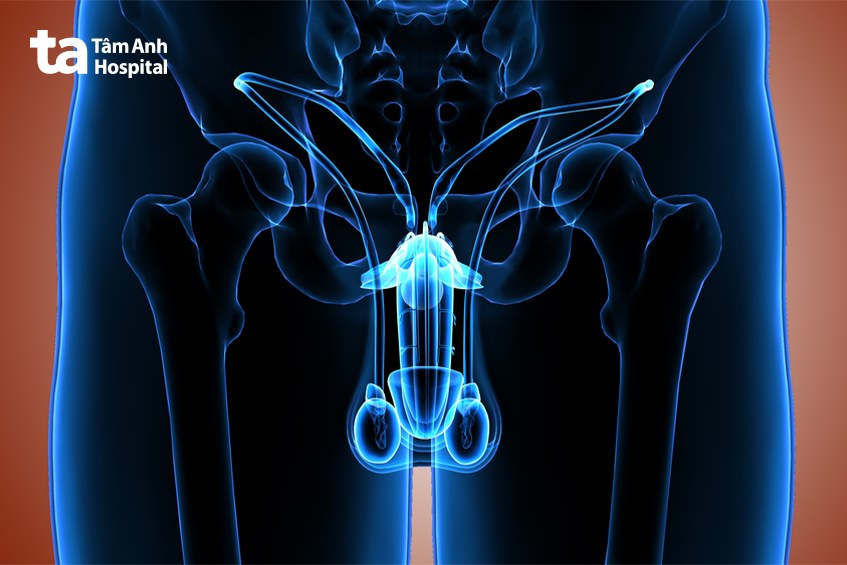 Đặt Tinh Hoàn Nhân Tạo Là Gì? Quy Trình, Hiệu Quả Và Mức Độ An Toàn Hiện Nay