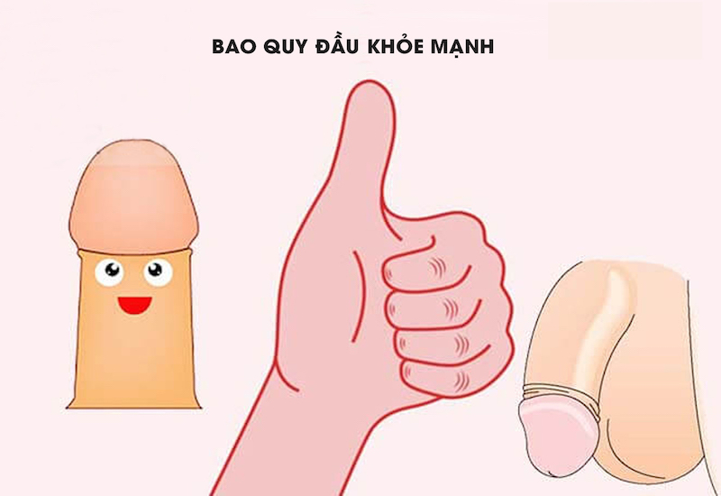 Dính Bao Quy Đầu Có Nguy Hiểm Không? Nguyên Nhân Và Những Điều Cần Biết
