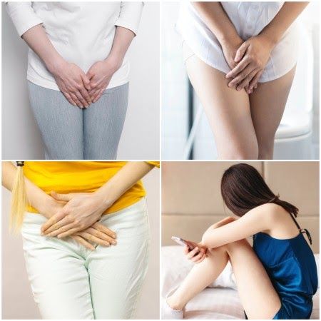 Giảm Ngứa Vùng Kín: Nguyên Nhân, Cách Khắc Phục Và Những Điều Cần Biết