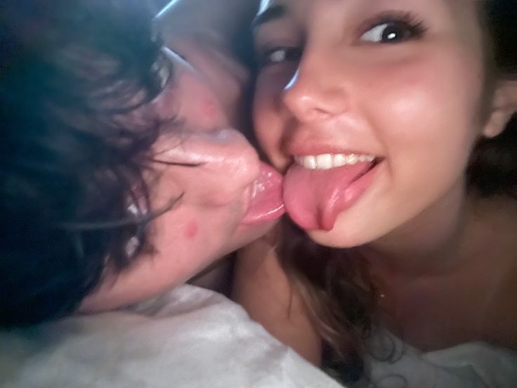 Hôn Nhau Có Lây Bệnh Sùi Mào Gà Không? Sự Thật Là Gì?