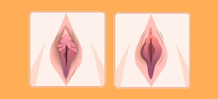 Tại sao vùng kín bị thâm? Nguyên nhân phổ biến và cách khắc phục an toàn