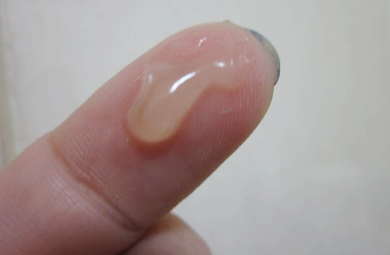 Nguyên Nhân Tình Trạng Tinh Trùng Yếu Thường Gặp Là Gì? Dấu Hiệu Và Cách Khắc Phục