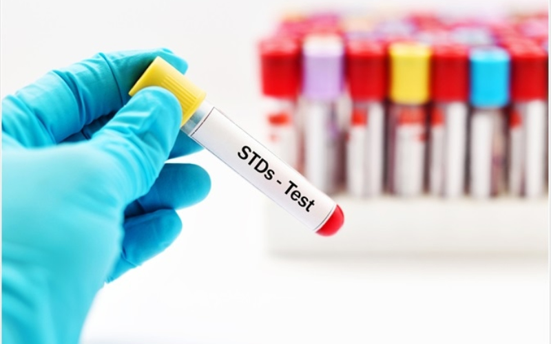 Tình dục thời sinh viên nên làm gì để an toàn cho sức khỏe? Hướng dẫn chi tiết cho GenZ