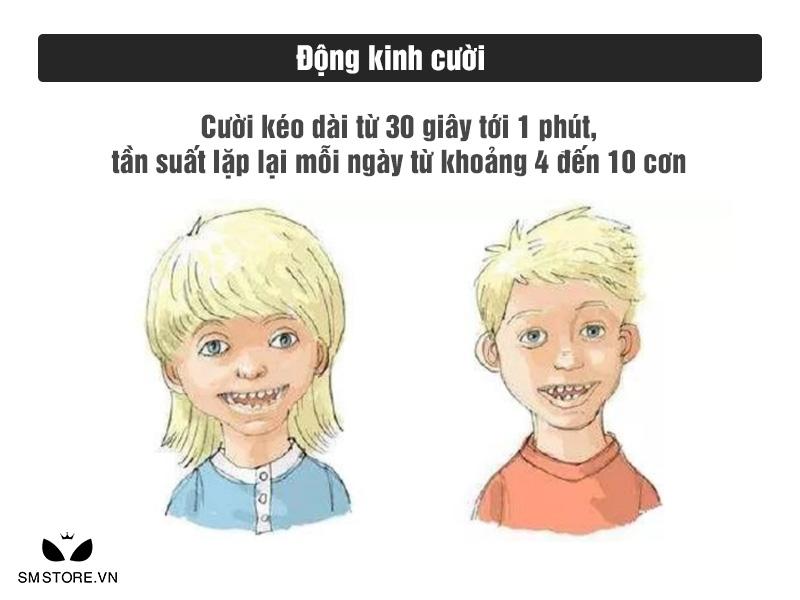 Bệnh động kinh cười ở trẻ em