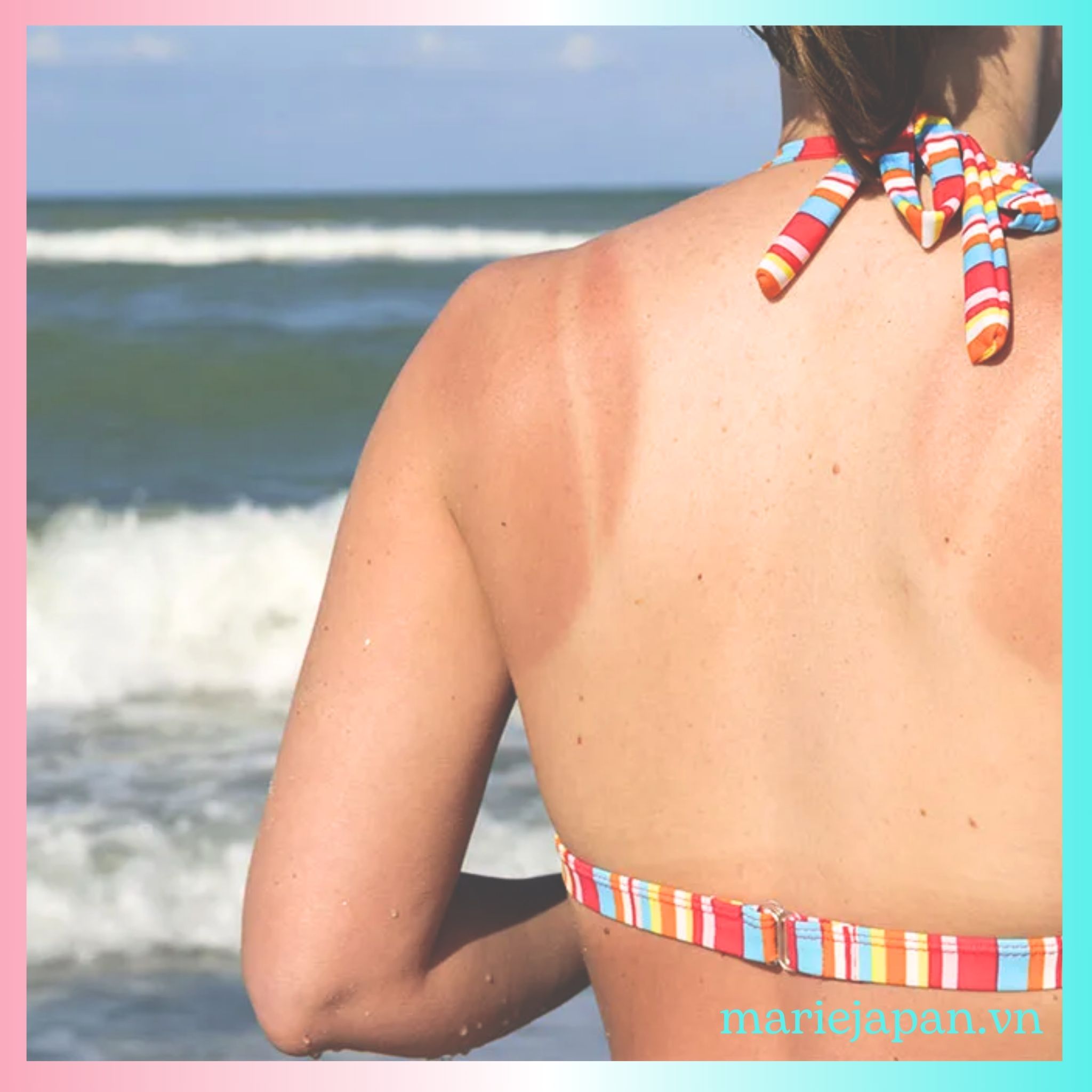 Lưu ý quan trọng khi chăm sóc da sau khi đi biển