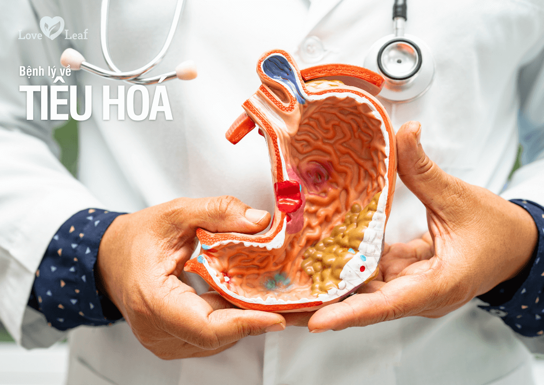 Bệnh lý về tiêu hoá là dấu hiệu gây hôi miệng