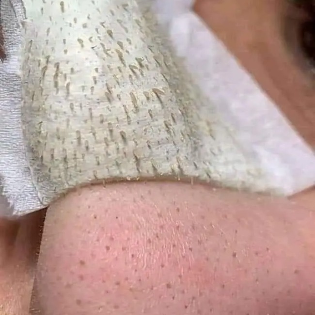 Keo Lột Mụn Handmade Mini Sạch Mụn Cám, Mụn Đầu Đen