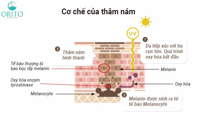 Các cơ chế hình thành của nám da