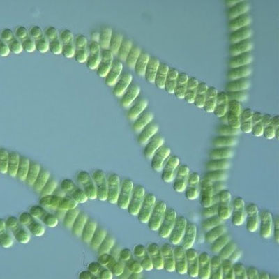 Nguồn gốc và lợi ích của tảo xoắn nhật bản