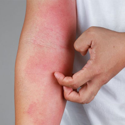 Một số tác dụng phụ có thể gặp phải khi sử dụng tảo xoắn