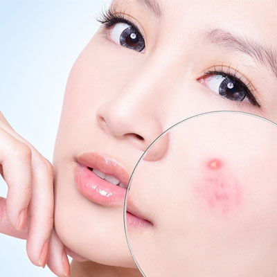 Tảo xoắn hỗ trợ làm đẹp da và cải thiện vóc dáng