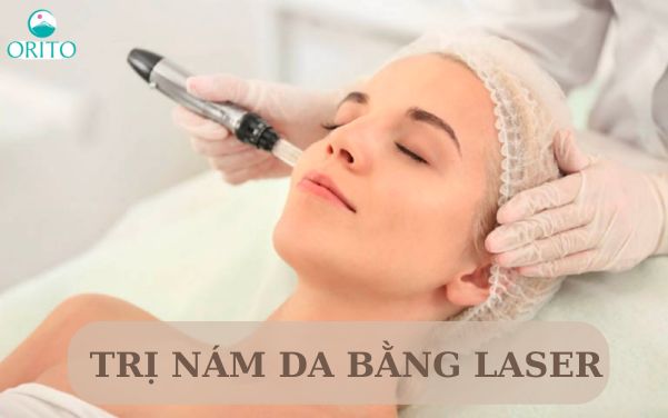 Cách trị nám bằng laser