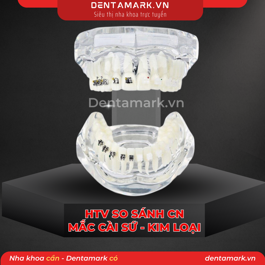 Mau ham tu van nha khoa, ham tu van benh nhan - Ham tu van chinh nha, ham tu van chinh nha mac cai kim loai, ham tu van chinh nha mac cai su, ham tu van so sanh chinh nha mac cai kim loai va mac cai su (1)