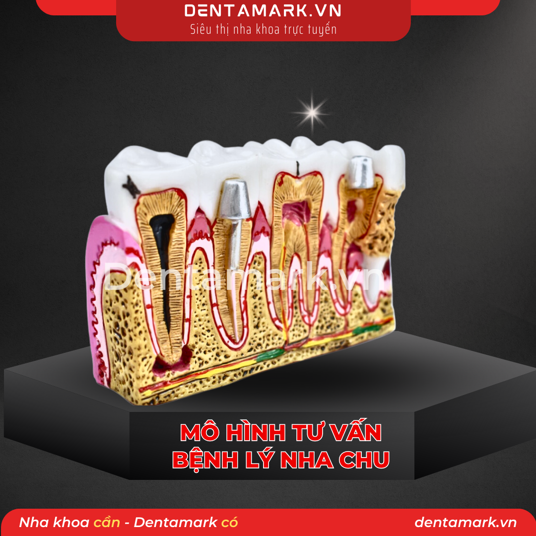 1 Mau ham tu van nha khoa, ham tu van benh nhan - Mo hinh tu van benh ly nha chu, mo hinh tu van nha chu, viem loi, noi nha, giai phau rang