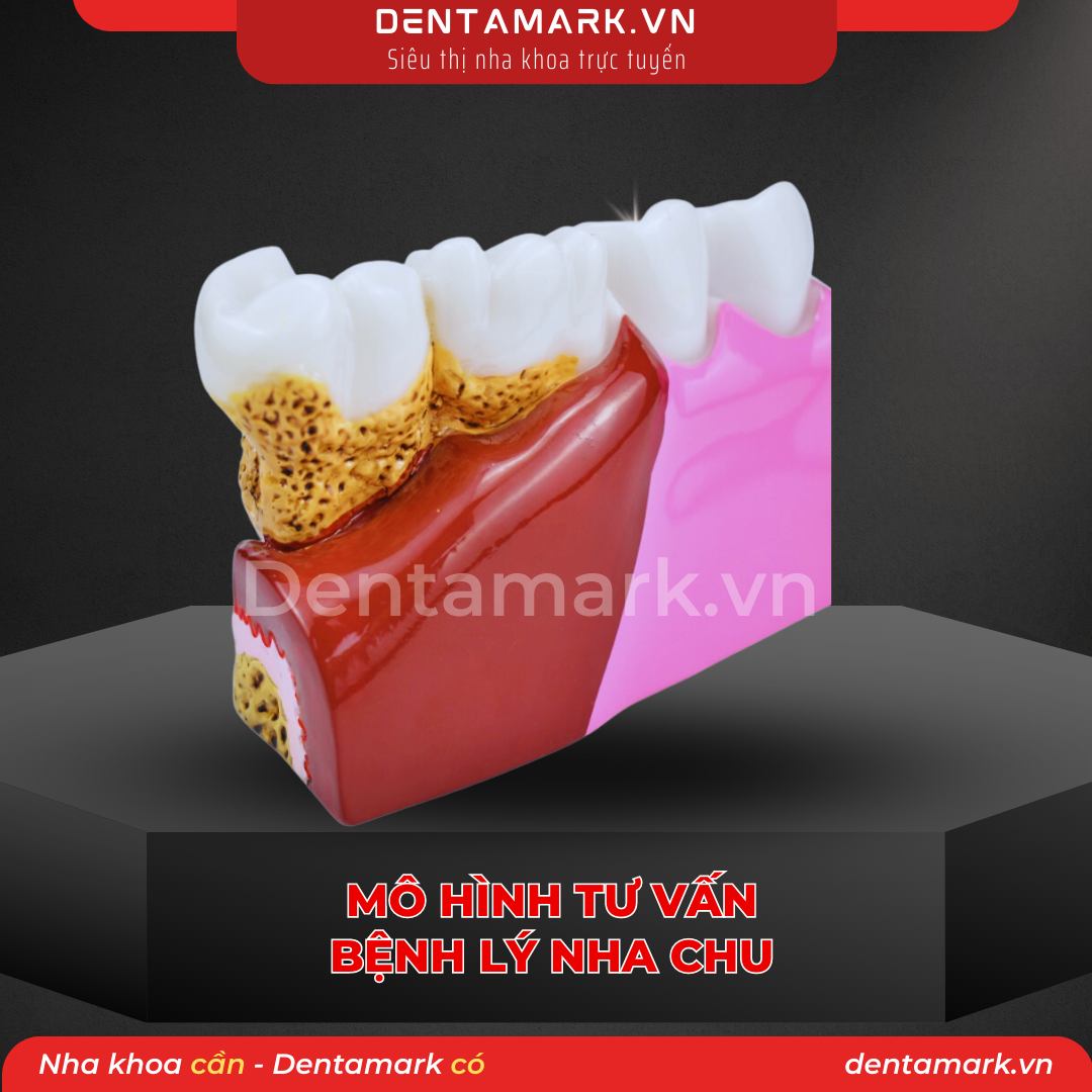 1 Mau ham tu van nha khoa, ham tu van benh nhan - Mo hinh tu van benh ly nha chu, mo hinh tu van nha chu, viem loi, noi nha, giai phau rang