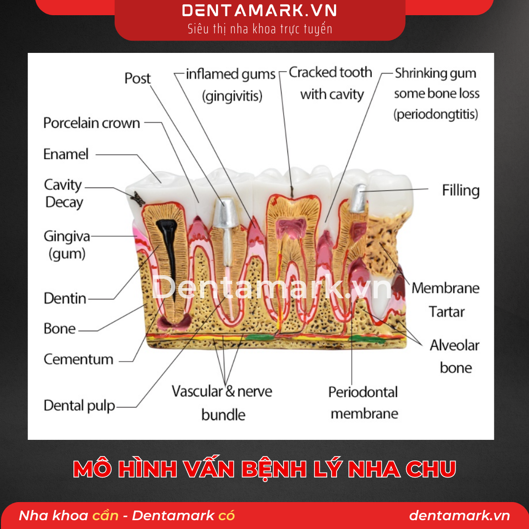 1 Mau ham tu van nha khoa, ham tu van benh nhan - Mo hinh tu van benh ly nha chu, mo hinh tu van nha chu, viem loi, noi nha, giai phau rang