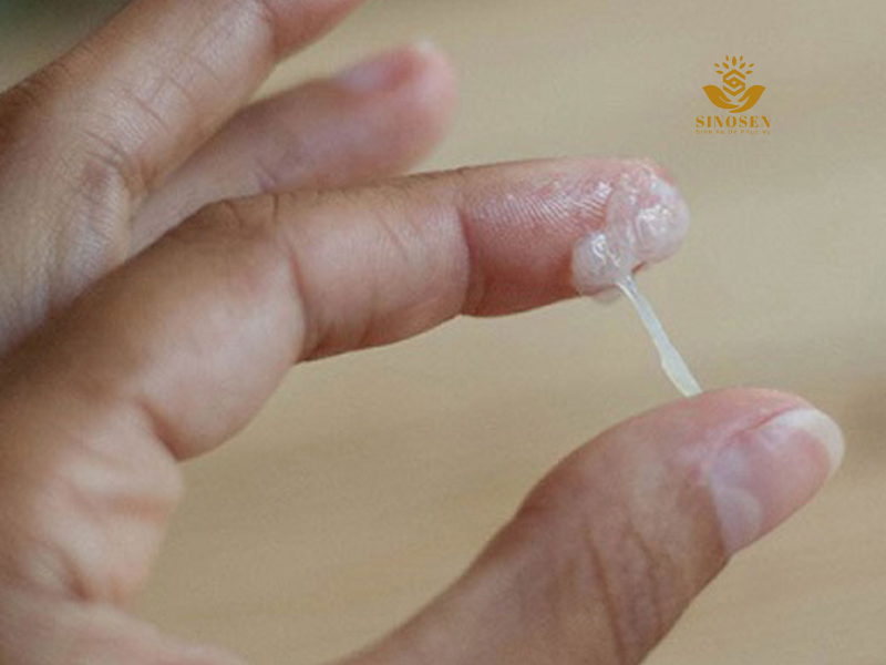 Phân biệt khí hư bình thường và khí hư bệnh lý